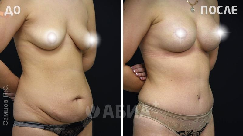 Пациетка Самцова Павла Сергеевича