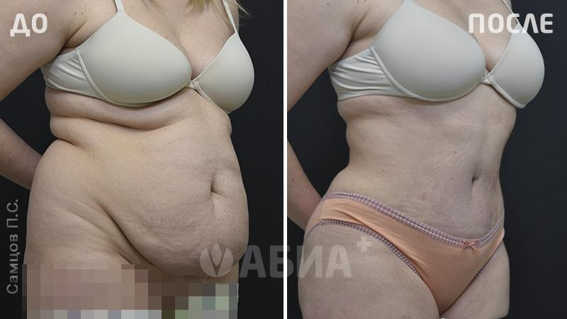 Пациентка Самцова Павла Сергеевича