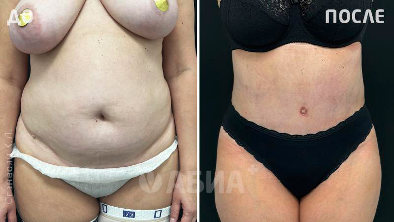 Пациентка Оганесян Карине Лёвовны