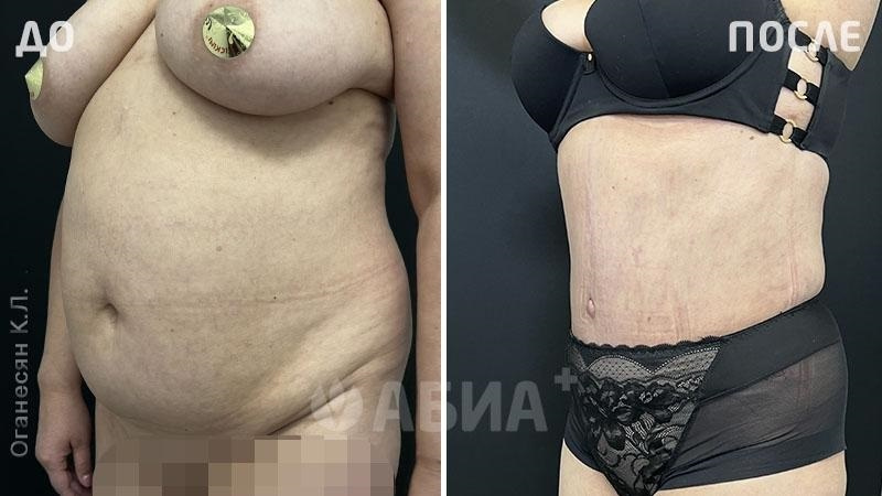 Пациентка Оганесян Карине Лёвовны