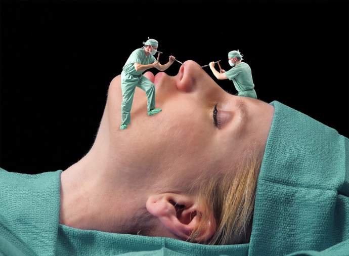 Пластические хирурги о своей работе: физическая нагрузка, как в контактном спорте