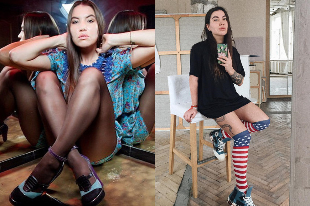 Рада Русских после пластики