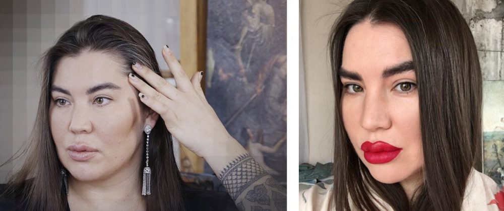 Рада Русских после пластики