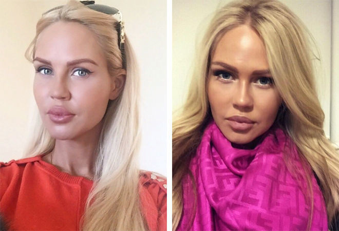 Мария Погребняк до и после пластики