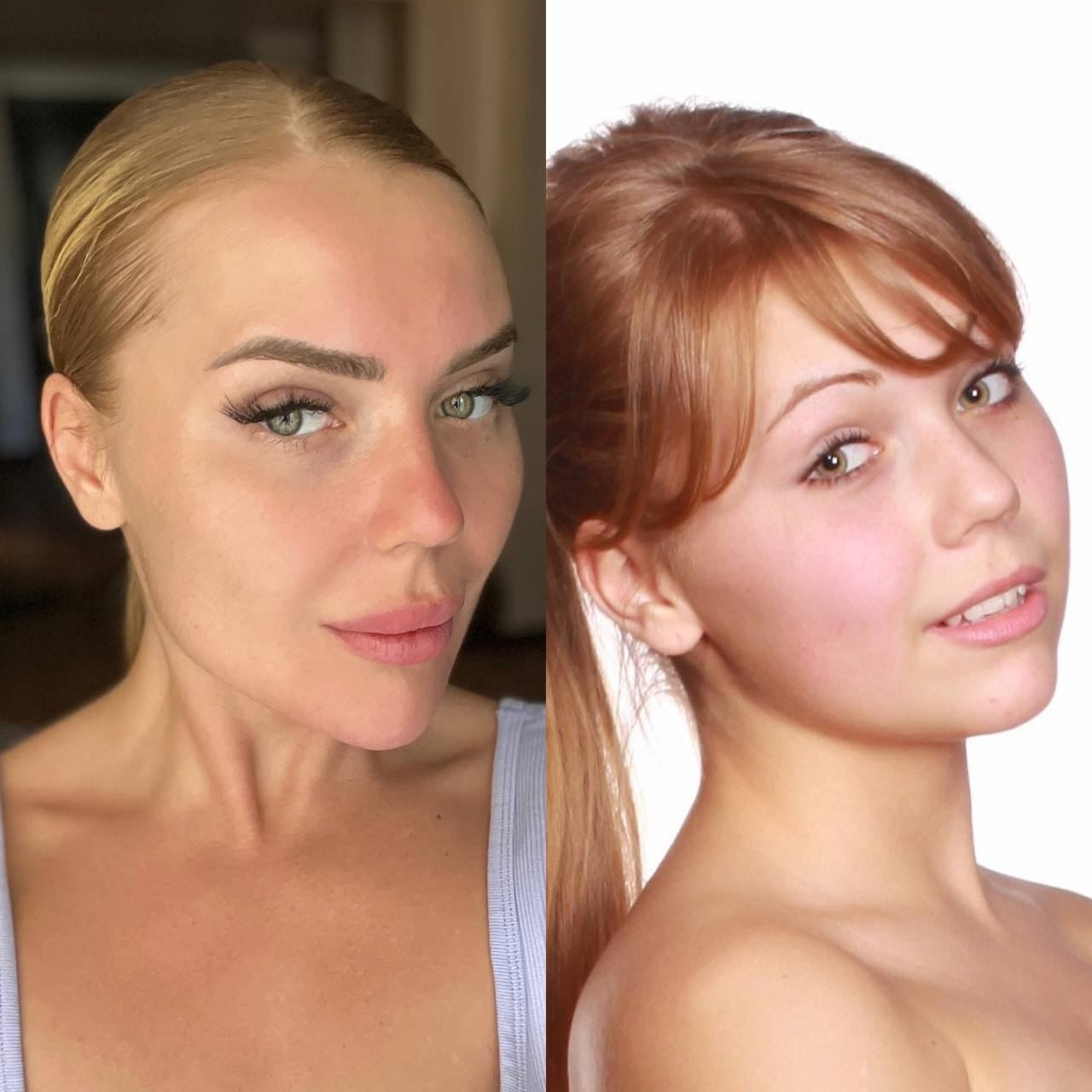 Карина Кросс до и после пластики