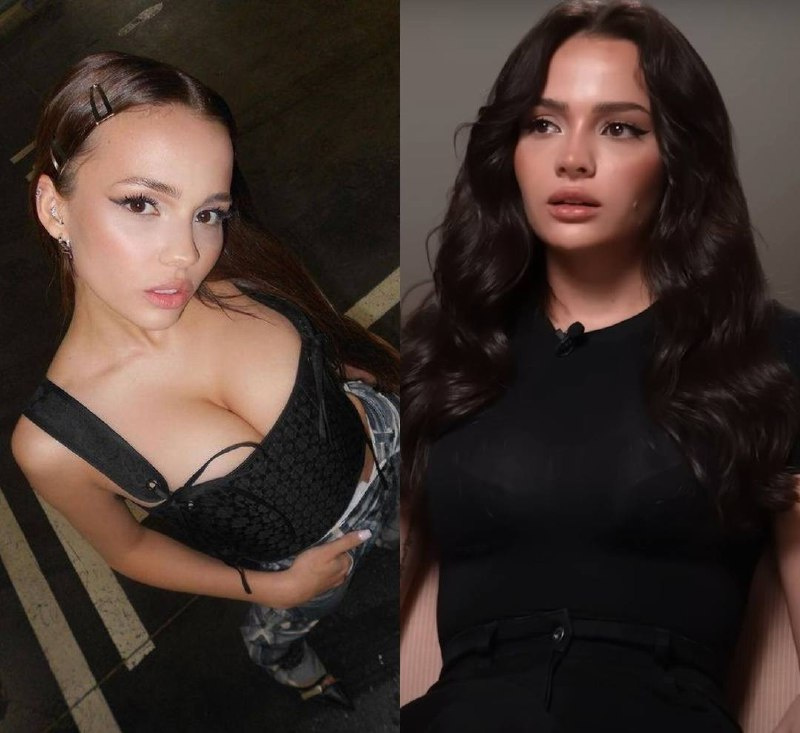 Валя Карнавал до и после пластики