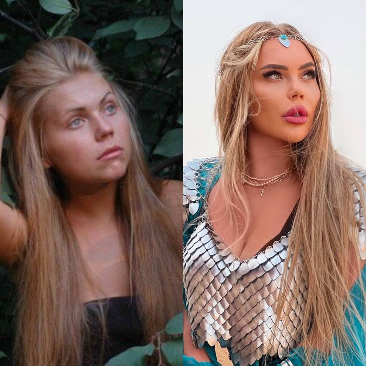 Карина Кросс до и после пластики носа