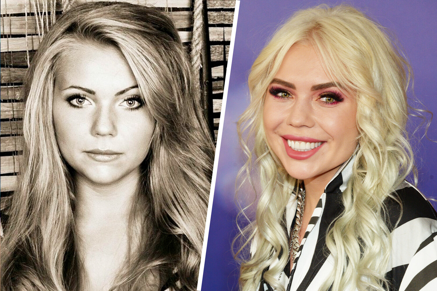 Карина Кросс фото до и после пластики