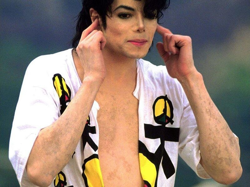 Витилиго Майкла Джексона