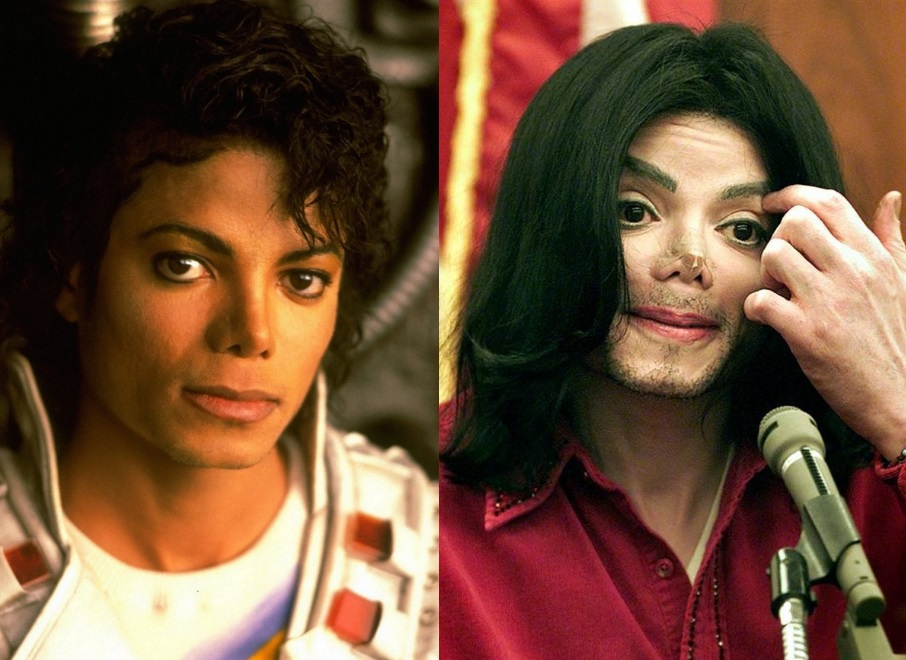 Майкл Джексон до и после операции