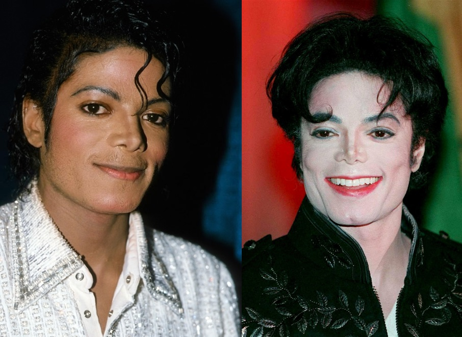 Цвет кожи Майкла Джексона