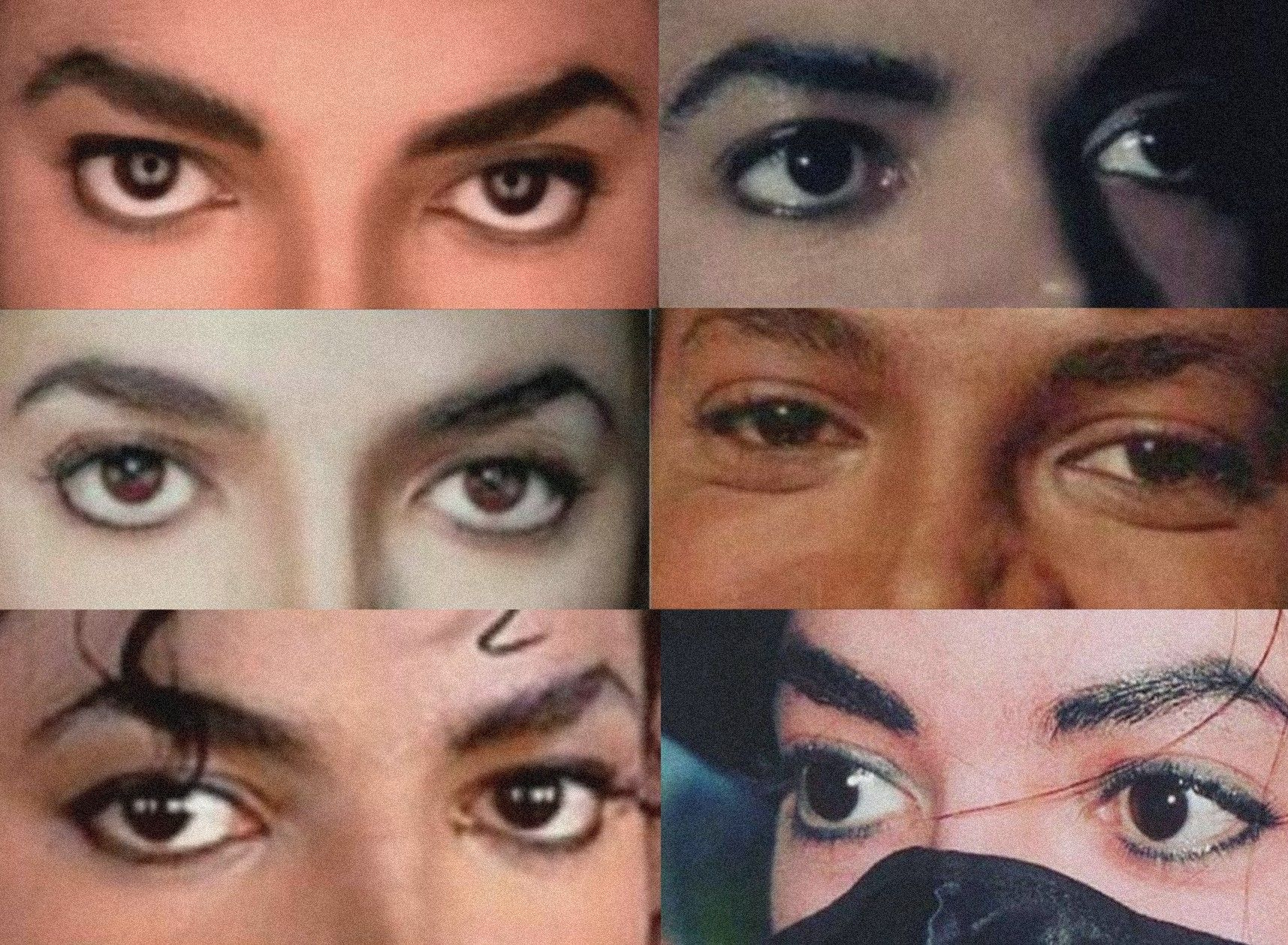 Глаза Майкла Джексона: фото до и после