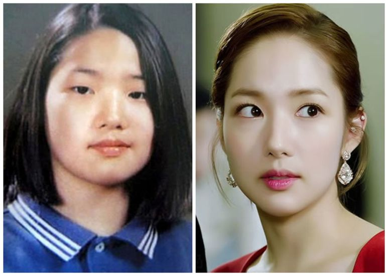 Пак Мин Ён до и после пластики