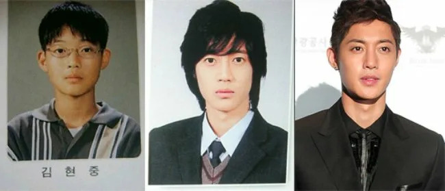 Ким Хен Джун до и после пластики