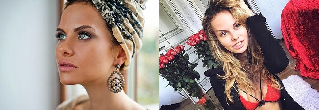 Аурика Алехина до пластики