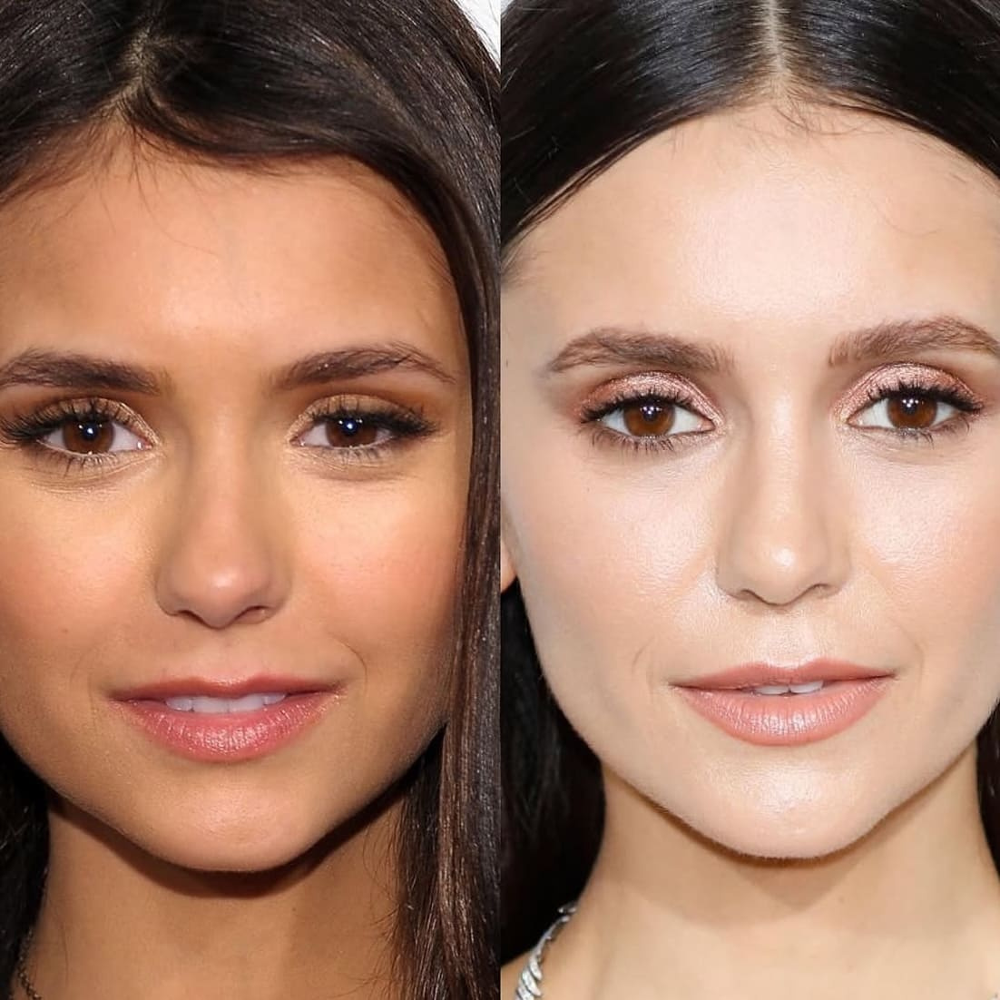 Нина Добрев до и после пластики