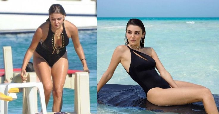 Ханде Эрчел до и после похудения