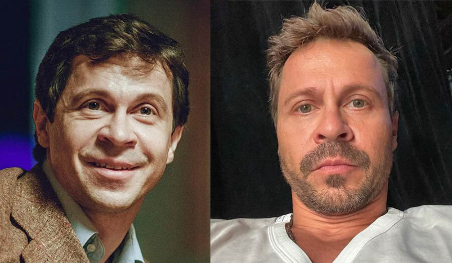 Павел Деревянко до и после пластики