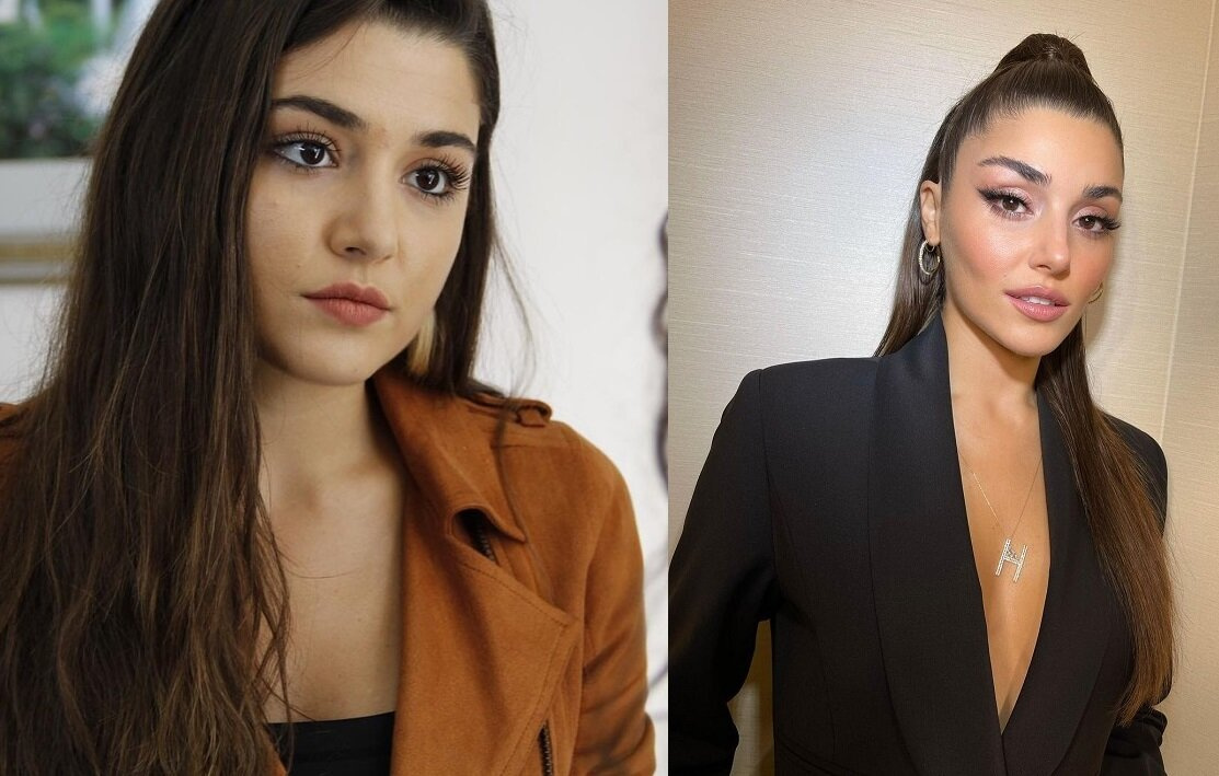 Ханде Эрчел до и после пластики