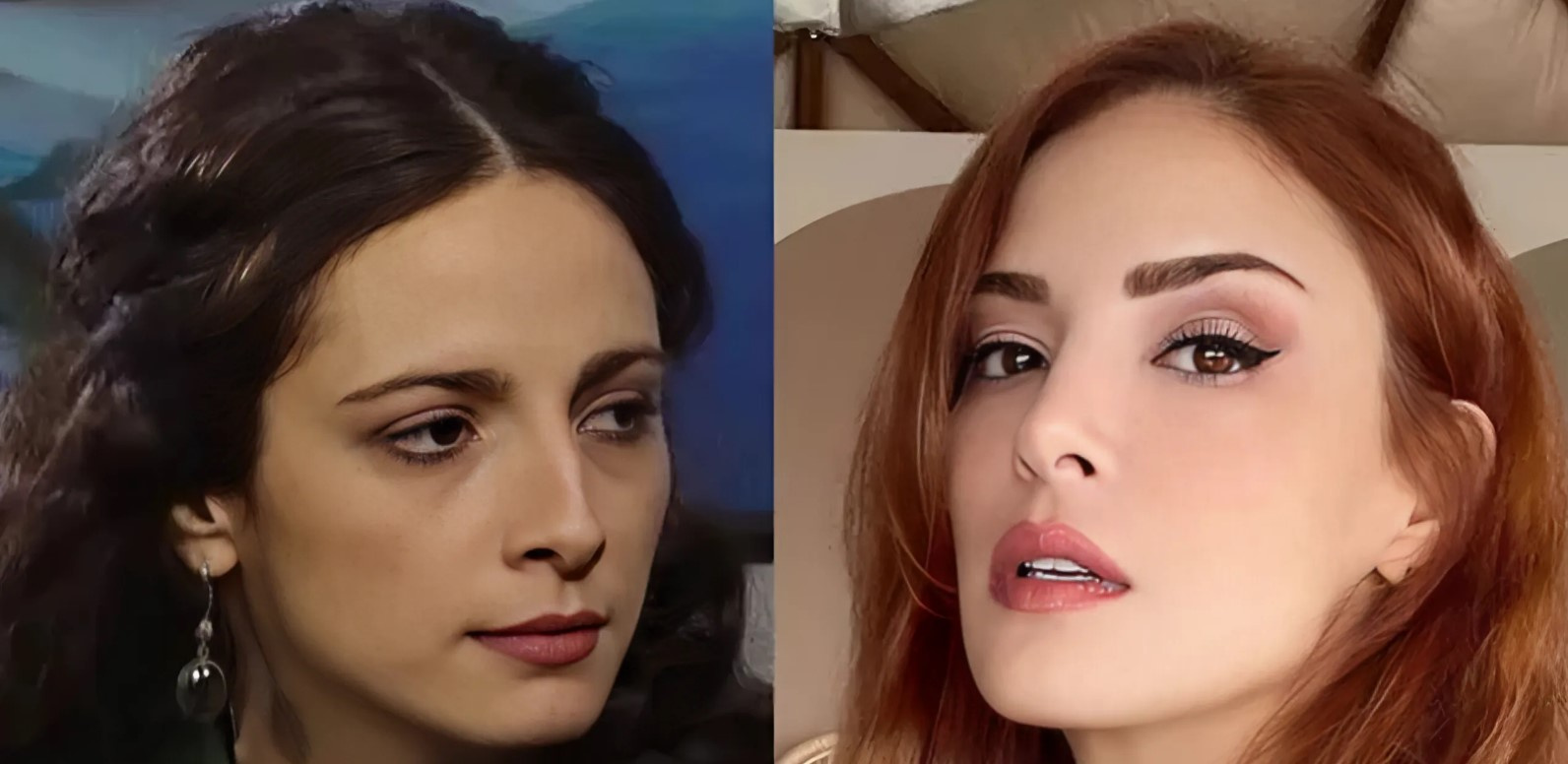 Мине Тугай до и после пластики