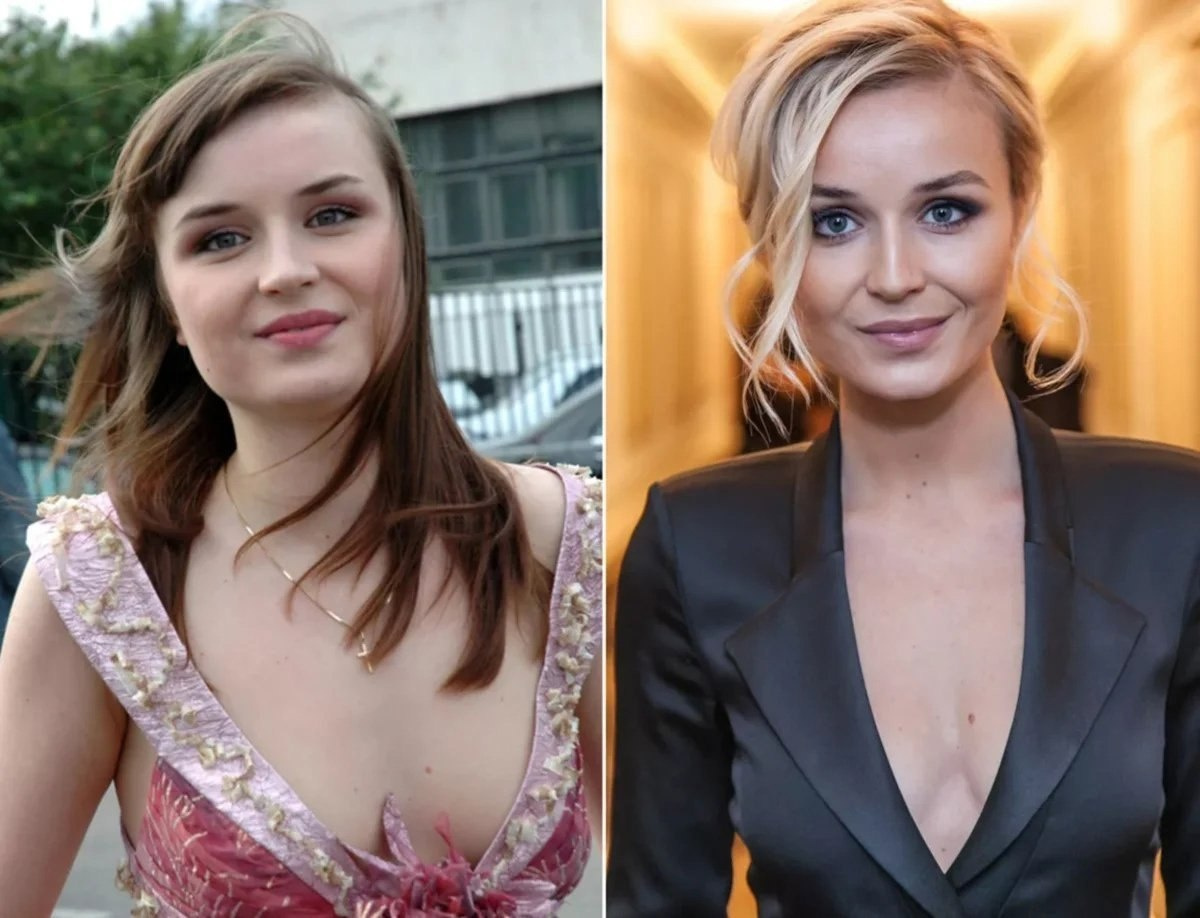 Полина Гагарина до и после похудения