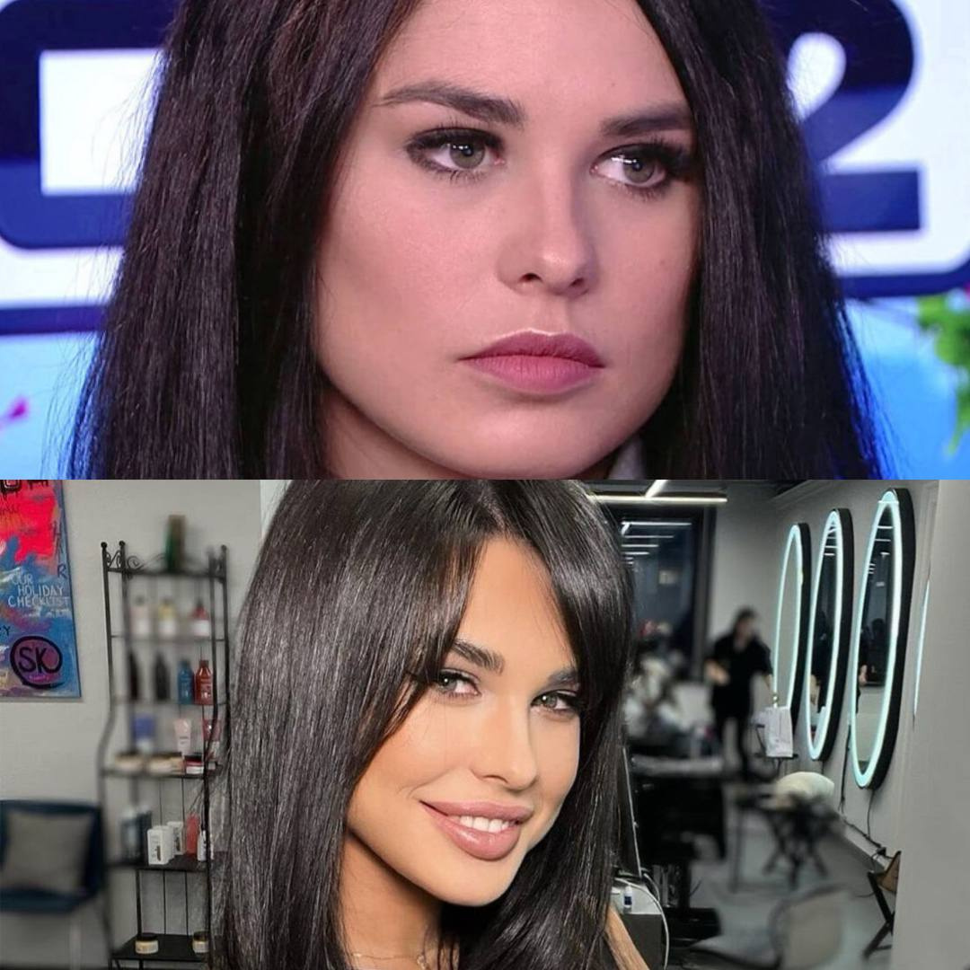 Ирина Пинчук до и после увеличения губ