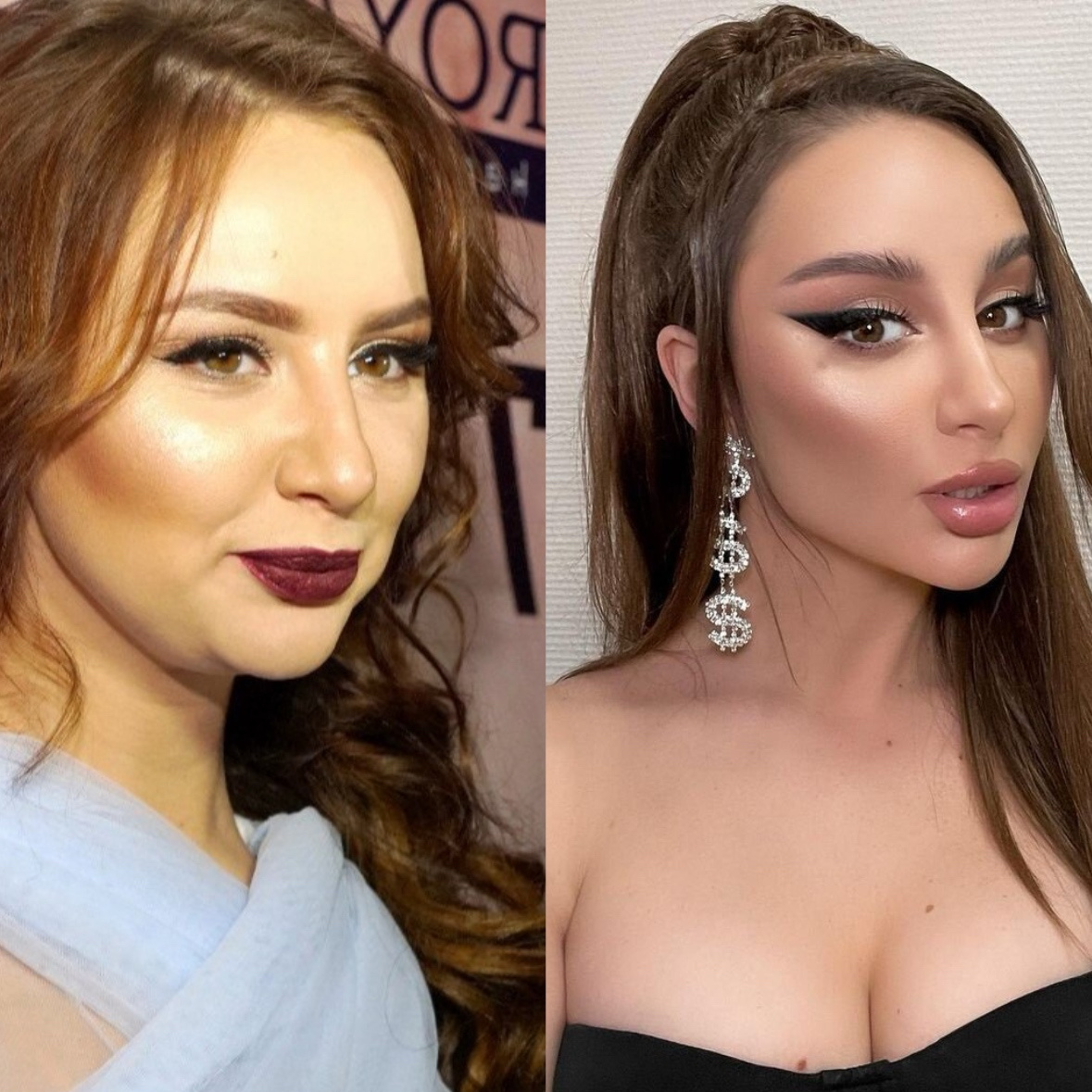 Анна Асти до и после пластики