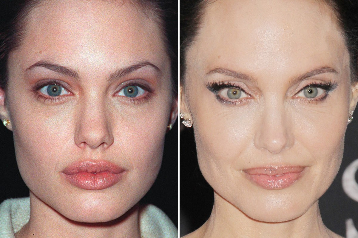 Анджелина Джоли до и после пластики