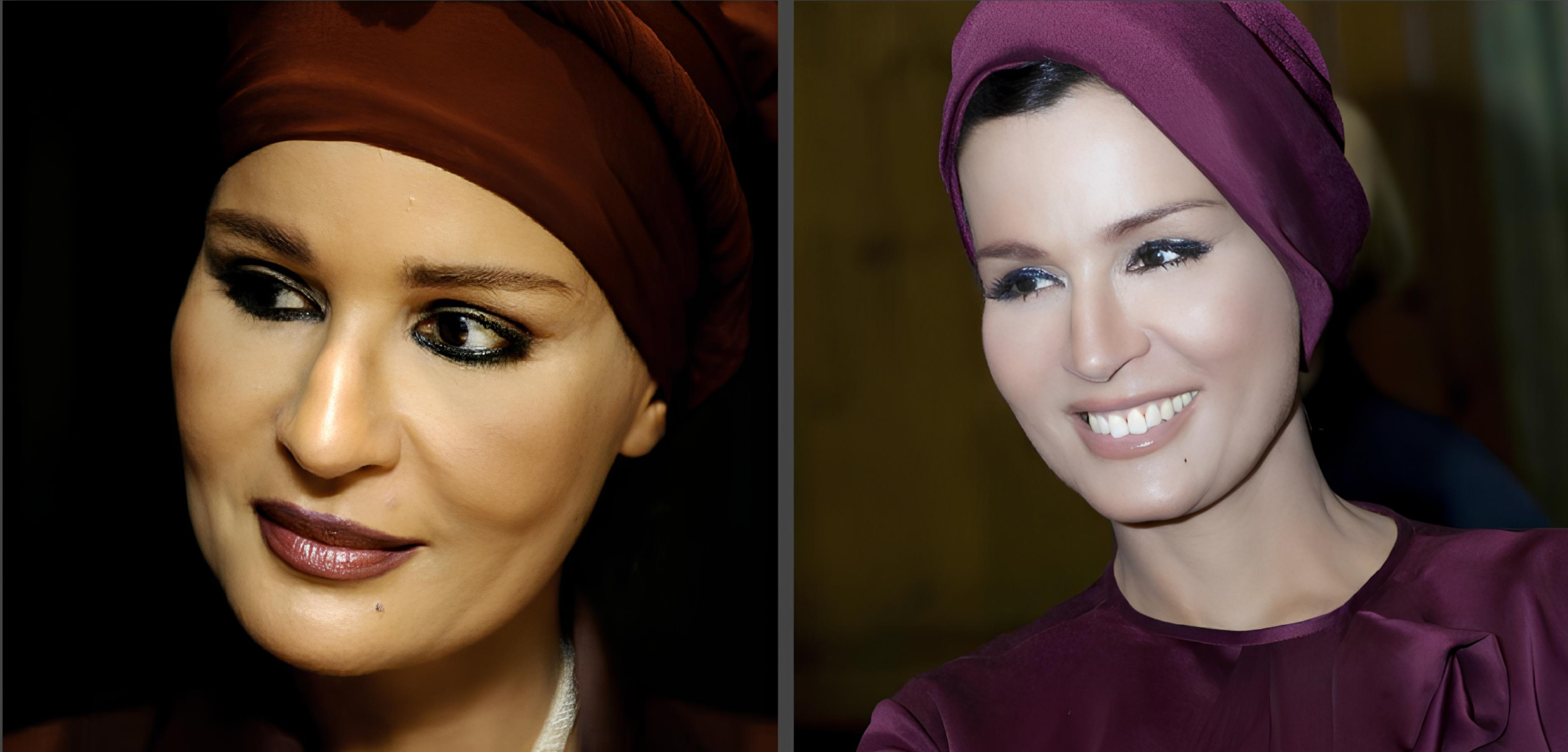 Шейха Моза до пластики