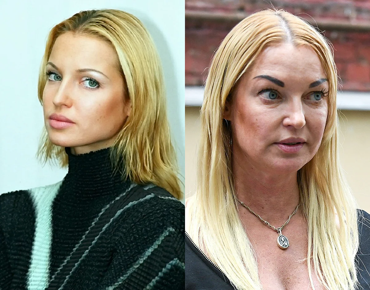 Анастасия Волочкова в молодости и сейчас