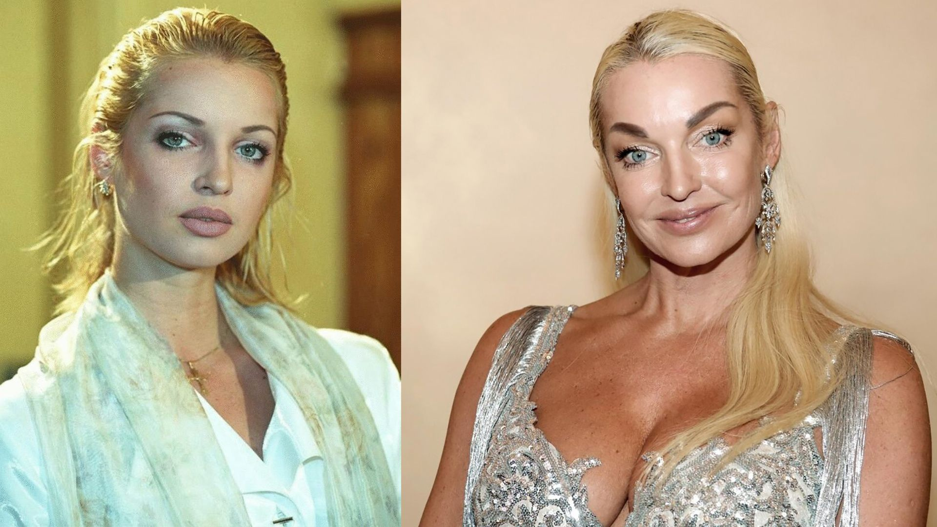 Анастасия Волочкова в молодости и сейчас