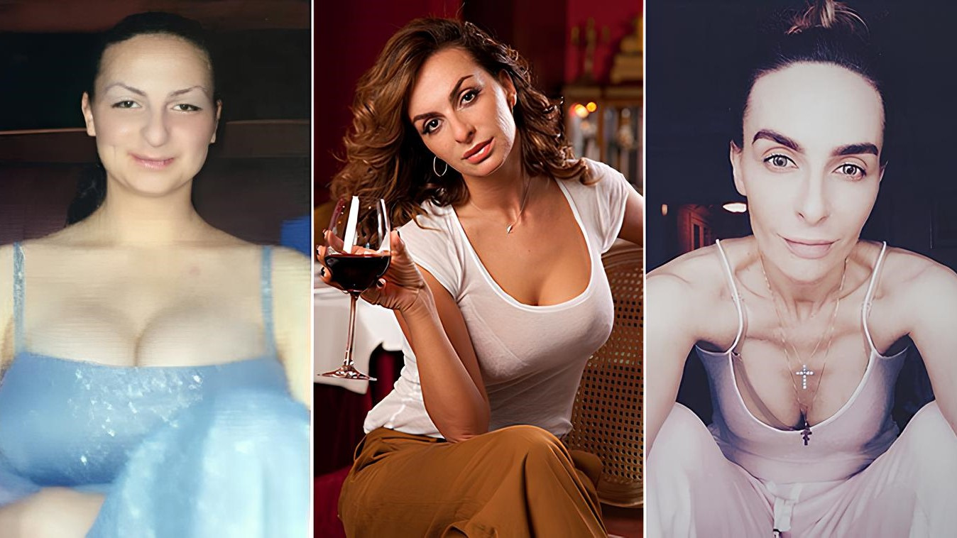 Грудь Екатерины Варнавы до и после уменьшения 