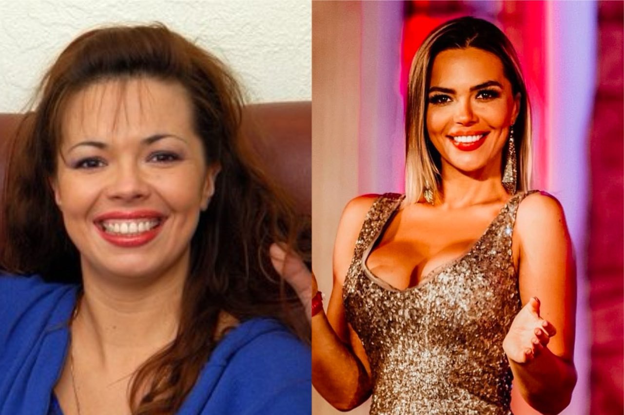 Карина Зверева до и после пластики