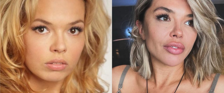 Карина Зверева до и после пластических операций