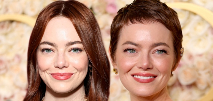 На 10 лет моложе: подтяжка Эммы Стоун