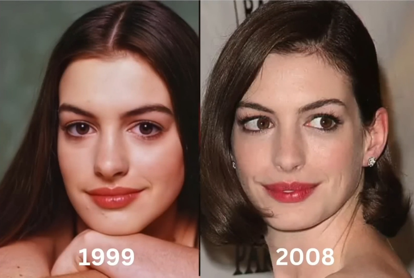 Энн Хэтэуэй до и после ринопластики (которой, возможно, не было)