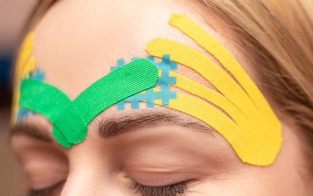 Тейпирование лба