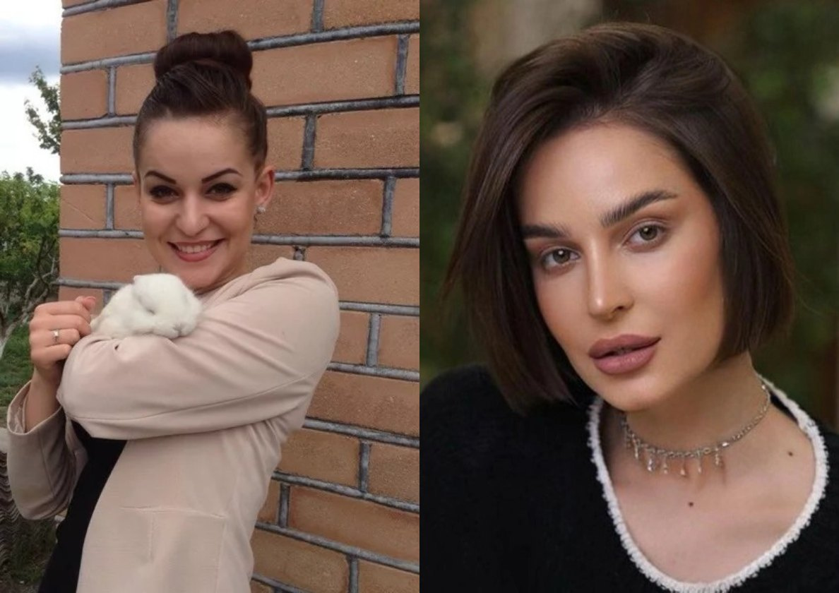 Севиль Велиева до и после пластики