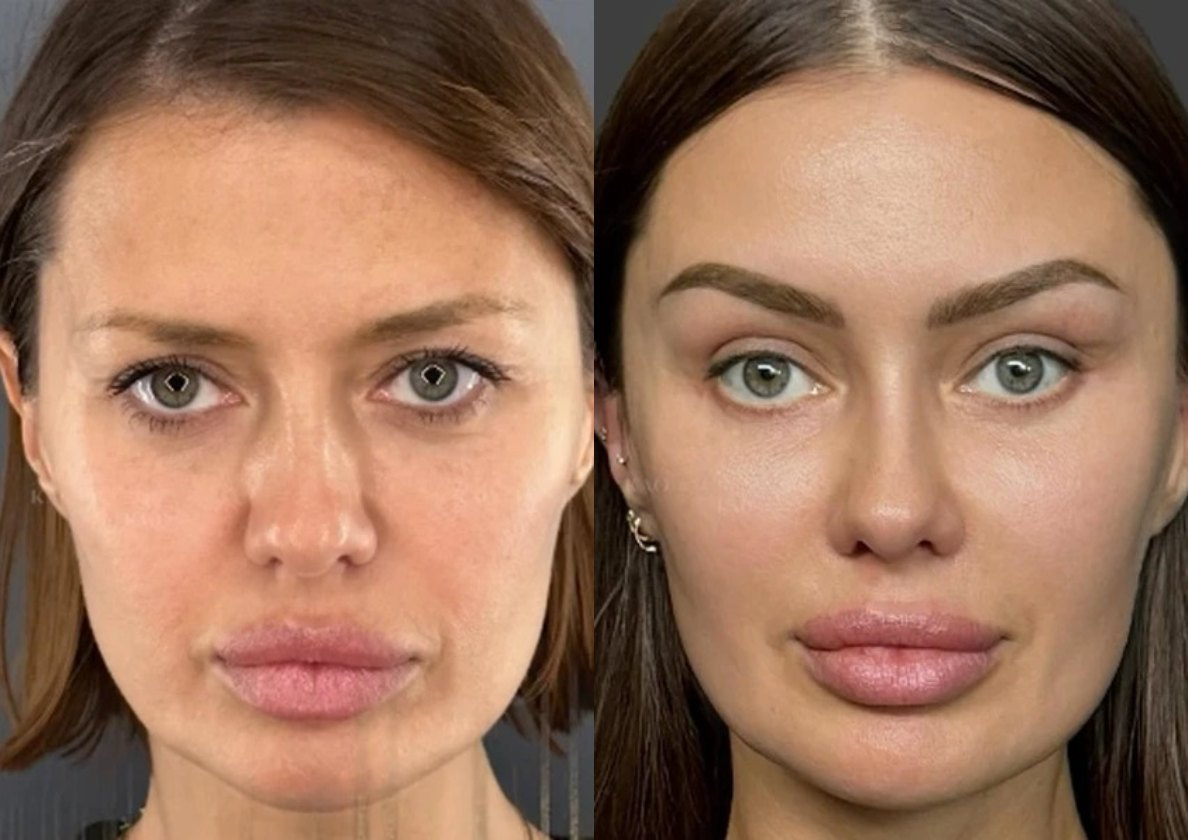 Преображение Виктории Бони