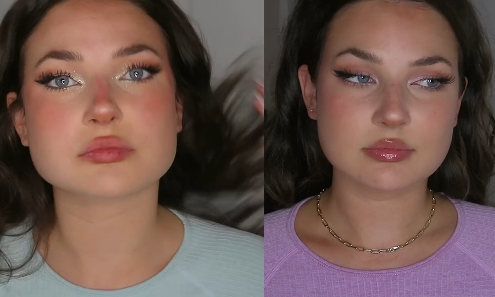 Блогер Тейлор Лайос до и после процедуры