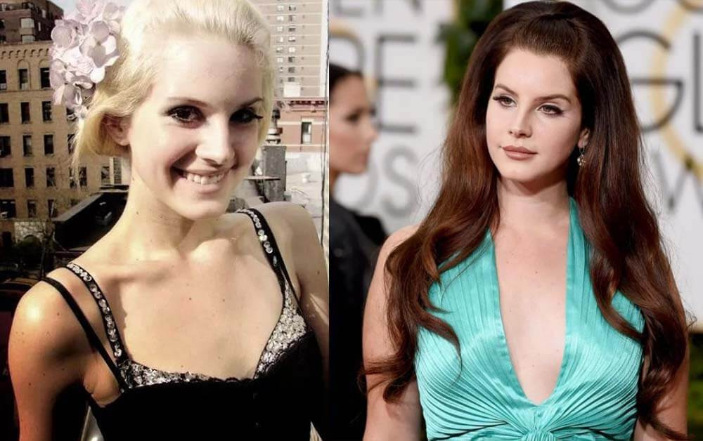 Фото: Лана Дель Рей до и после