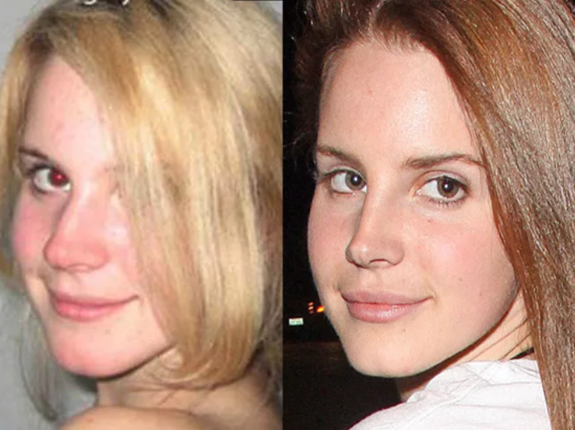 Фото: Лана Дель Рей до и после