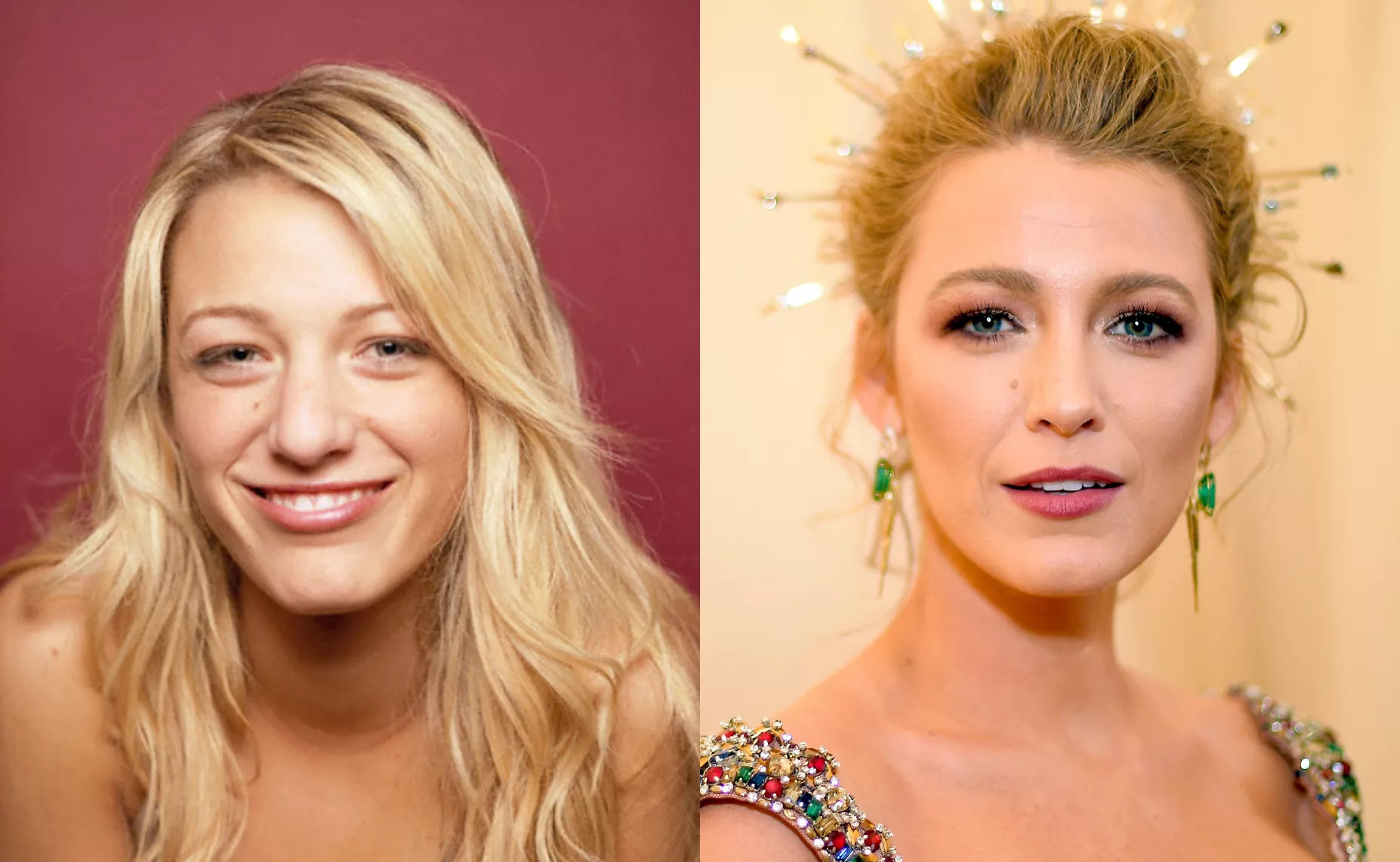 Блейк Лайвли до и после ринопластики